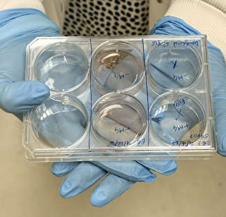 Organoids at Tisch MSRCNY