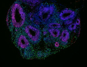 an organoid