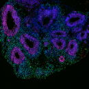 an organoid